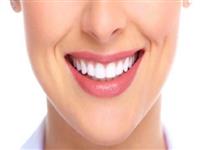 Bọc Răng Sứ Duy Trì Được Bao Lâu?