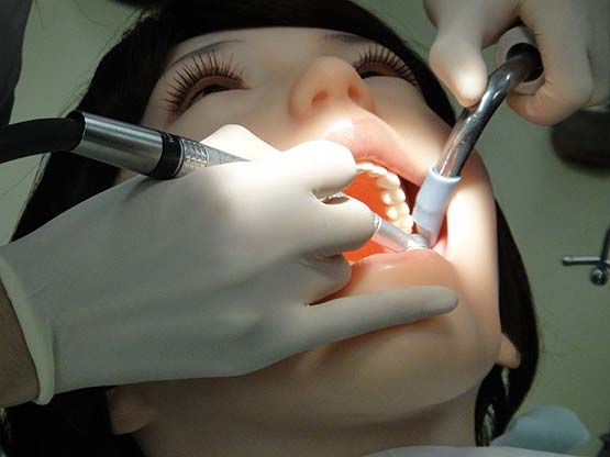 Các loại trâm nội nha