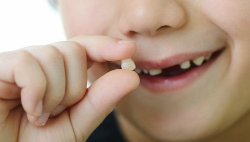 Nằm mơ thấy rụng răng hàm trên có ý nghĩa gì?